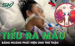 Người đàn ông 51 tuổi bàng hoàng phát hiện ung thư thận từ dấu hiệu tiểu ra máu