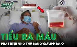 Phát hiện ung thư bàng quang đa ổ từ dấu hiệu tiểu ra máu