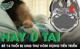 Bé trai 14 tuổi liên tục ù tai, bác sĩ phát hiện ung thư vòm mũi họng giai đoạn tiến triển