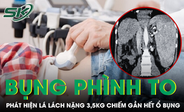Bụng phình to không đại tiện được, bàng hoàng phát hiện lá lách nặng 3,5kg