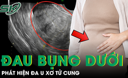 Ngỡ đau bụng kinh bình thường, người phụ nữ phát hiện đa u xơ tử cung