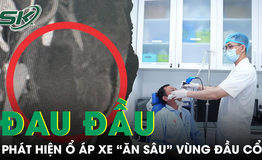 Đau đầu kéo dài, phát hiện ổ áp xe 'ăn sâu' vùng đầu cổ