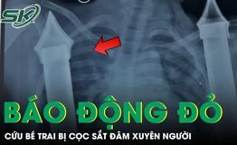 Bé trai 6 tuổi nguy kịch do cọc sắt xuyên từ bụng xuống tầng sinh môn