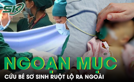 Bé sơ sinh ruột lộ ngoài cơ thể, được cứu sống sau ca mổ khẩn
