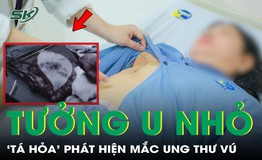 Tưởng chỉ là u nhỏ, người phụ nữ ‘tá hoả’ mắc ung thư vú