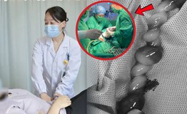 Bác sĩ kể khoảnh khắc sinh tử cứu thai nhi dây rốn xoắn tới 40 vòng