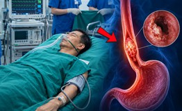 Làm 3 việc này suốt 30 năm, người đàn ông phát hiện mắc ung thư thực quản