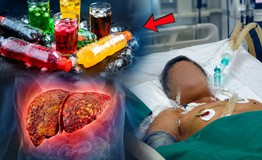 Uống nhiều nước ngọt có làm tăng nguy cơ ung thư gan?