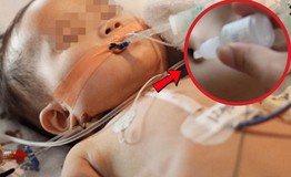 Bé gái 19 tháng tuổi cấp cứu ngưng thở vì ngộ độc thuốc nhỏ mũi