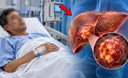 Ung thư gan ‘nhắm’ đến ai, yếu tố nguy cơ cần đặc biệt lưu ý