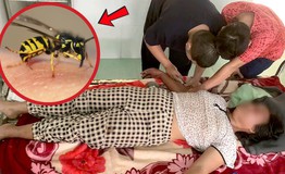 Người phụ nữ hôn mê vì ong vò vẽ đốt 20 nốt khi đi chăn bò