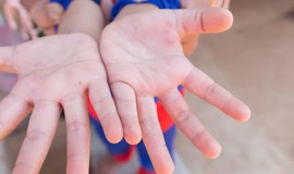 Bác sĩ nhi khoa hướng dẫn chăm sóc trẻ mắc tay chân miệng chuẩn bệnh viện tại nhà