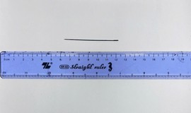 Lấy thành công kim khâu dài 6 cm nằm trong gan người đàn ông 