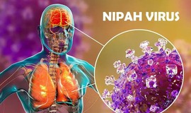 Bộ Y tế chính thức hướng giám sát và phòng bệnh do do virus Nipah ở người
