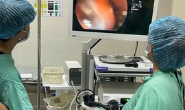 Từ ca bệnh nuốt 3 bàn chải đánh răng, cảnh báo biến chứng nguy hiểm bởi dị vật 'quá khổ'