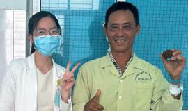 Người đàn ông 49 tuổi mang viên sỏi tiết niệu 'khổng lồ'