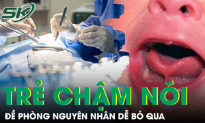 Đề ph&#242;ng nguy&#234;n nh&#226;n g&#226;y chậm n&#243;i ở trẻ nhiều phụ huynh dễ bỏ qua