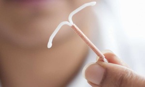 Đau bụng nhiều năm, ph&#225;t hiện v&#242;ng tr&#225;nh thai &#39;đi lạc&#39; trong ổ bụng