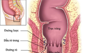 Quan hệ tình dục qua đường hậu môn: Con đường lây nhiễm HIV nguy hiểm nhất, làm sao để bảo vệ bản thân?