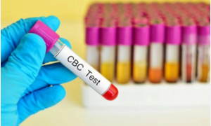 Những chỉ số máu quan trọng giúp quản lý HIV hiệu quả