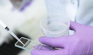 3 chiến lược bảo tồn khả năng sinh sản cho người nhiễm HIV