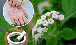 Sử dụng cây vòi voi chữa bệnh thế nào cho đúng?