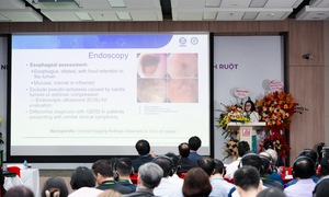 Việt Nam đón đầu các kỹ thuật mới trong điều trị nhu động thần kinh ruột