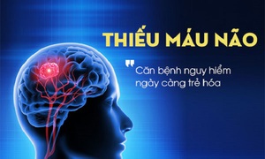 B&#237; quyết giảm nguy cơ cơn thiếu m&#225;u n&#227;o tho&#225;ng qua