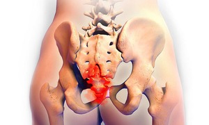 Phụ nữ chưa sinh con vẫn có thể bị rối loạn sàn chậu