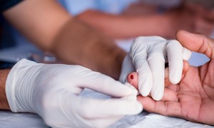 Xét nghiệm HIV có được bảo mật không?