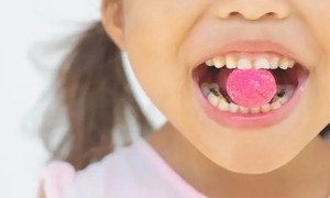 7 loại thực phẩm làm tăng nguy cơ sâu răng bạn nên biết để tránh