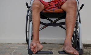 Virus bại liệt: Nguy cơ x&#226;m nhập trở lại v&#224; tầm quan trọng sống c&#242;n của vaccine