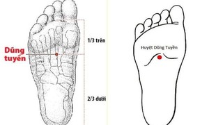 B&#225;c sĩ y học cổ truyền khuyến c&#225;o một số biện ph&#225;p ph&#242;ng ngừa đột quỵ v&#224;o m&#249;a lạnh
