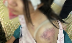 Cục Bà mẹ và Trẻ em lên tiếng vụ cháu bé bị bạo hành tại Thái Nguyên