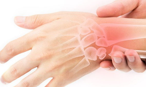 5 b&#224;i tập đơn giản giảm đau ng&#243;n tay, cổ tay do sử dụng điện thoại di động