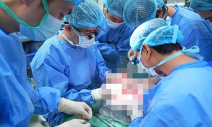 Bệnh nh&#226;n mắc vi&#234;m gan B, ung thư gan t&#225;i ph&#225;t được cứu nhờ gh&#233;p gan từ vợ hiến tặng