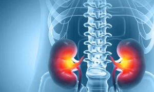 Tổn thương thận &#226;m thầm từ thực phẩm chức năng v&#224; vitamin ‘tốt cho sức khỏe’