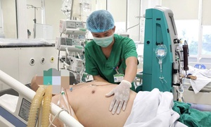 Sốt xuất huyết diễn biến nguy kịch ở bệnh nhân có nhiều bệnh nền