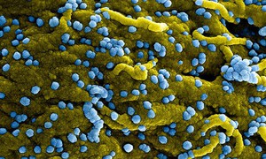 Tanzania tuyên bố kết thúc đợt bùng phát bệnh do virus Marburg thứ hai