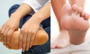 Điều trị kịp thời ca bệnh di truyền hiếm gặp sau nhiều năm bị chẩn đoán nhầm