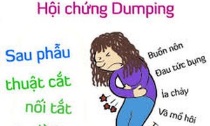 Điều trị Hội chứng Dumping dùng thuốc nào?