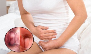 Viêm âm đạo và mối nguy hiểm với khả năng sinh sản