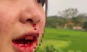 Đang xác minh vụ tài xế ô tô hành hung cô gái chảy máu mũi ở Bắc Giang