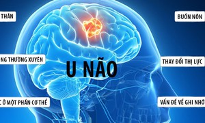 Làm thế nào để biết mình bị u não?