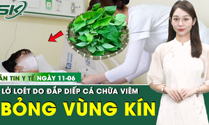 Bản tin Y tế 11/6: Đắp diếp cá vào 'vùng kín', người phụ nữ bỏng nặng toàn bộ vùng sinh dục