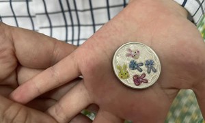 Bé gái nguy kịch vì nuốt phải đồng xu