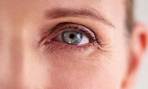 Mẹo chăm sóc vùng da quanh mắt, giảm nếp nhăn