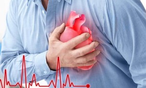 Dấu hiệu sớm cảnh báo nhồi máu cơ tim cấp