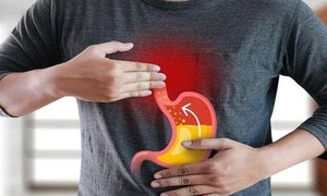 6 loại thực phẩm bổ sung giúp giảm trào ngược axit dạ dày