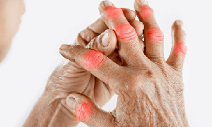 7 loại củ quả có lợi cho người bệnh viêm khớp dạng thấp